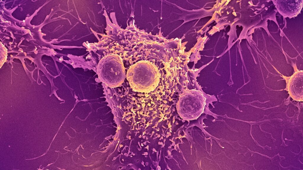 Study finds that COVID-19 mRNA vaccines can force the immune system to recognize and kill cancer.