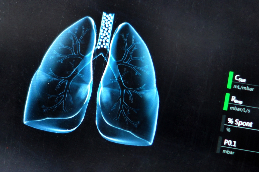 Researchers test world’s first lung cancer vaccine