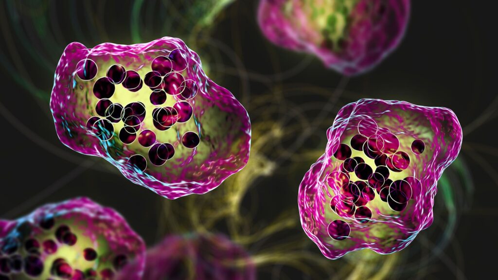 South Carolina measles outbreak is the largest since the U.S. eradicated measles