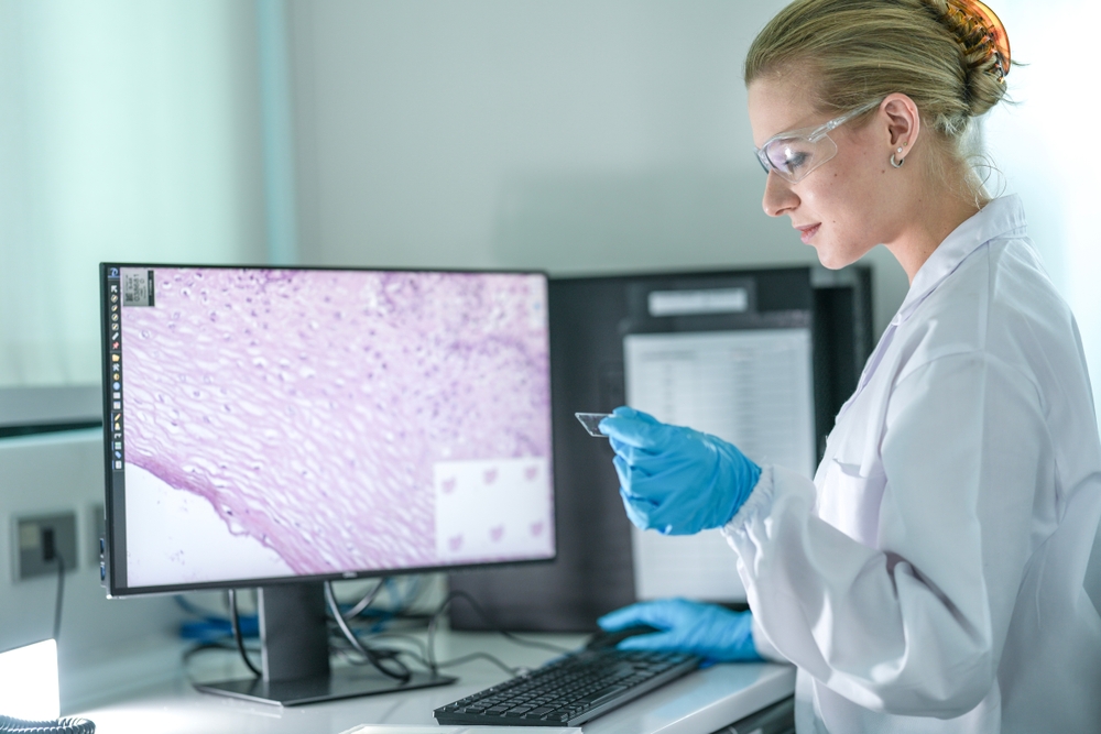 New UK funding to tackle regional inequalities in cancer screening