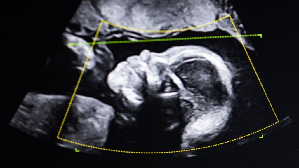 “I’m not lying. So who are you?”: What happens when a DNA test shows that a woman is not the mother of the child she gave birth to?