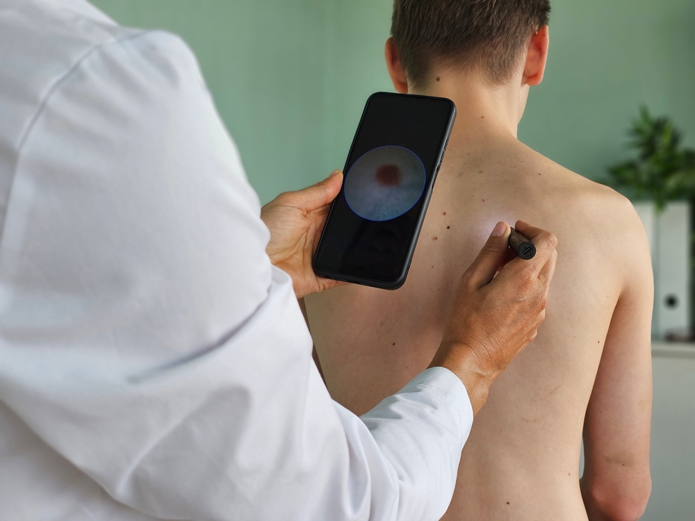 AI predicts early skin cancer risk with 73% accuracy