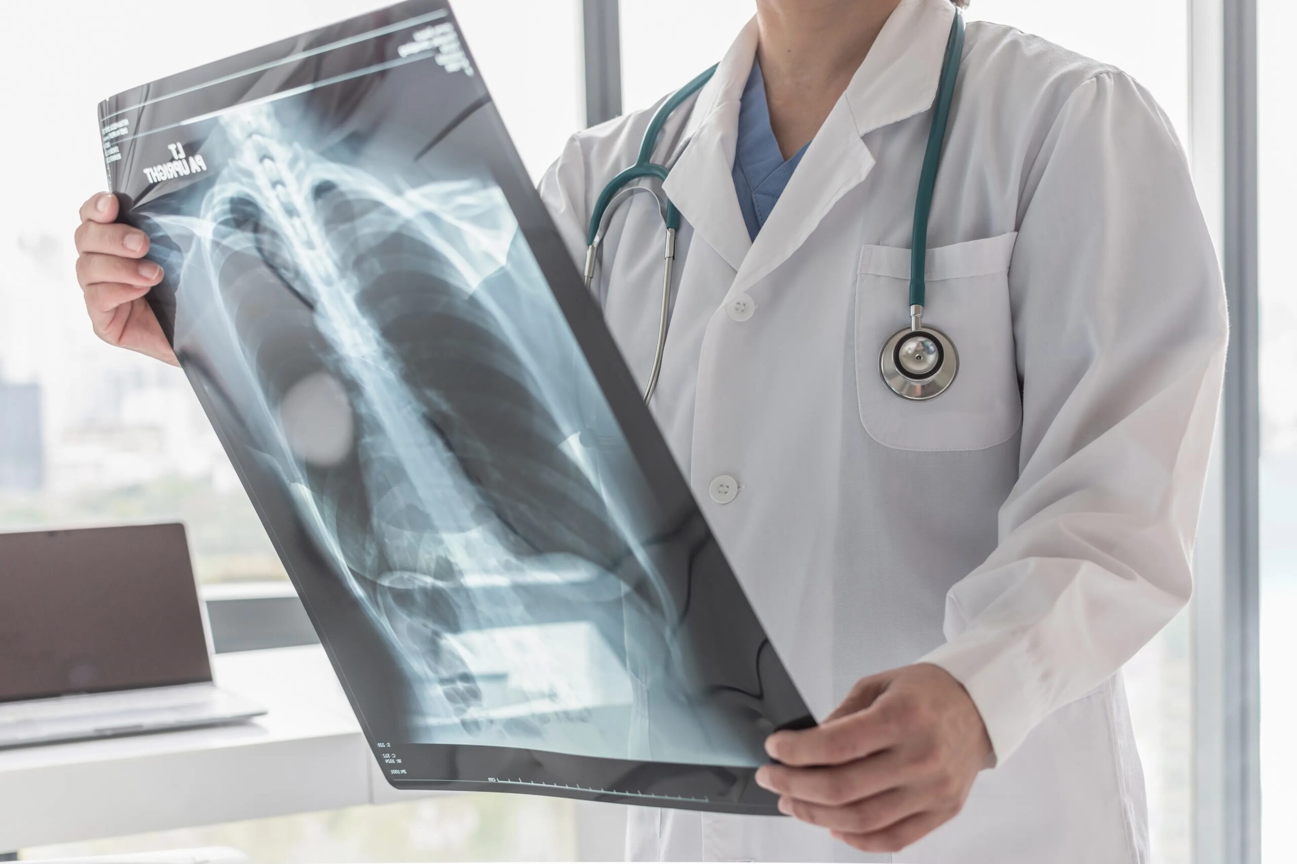 Years After He Quit Smoking, a Lung Cancer Scan Saved His Life
