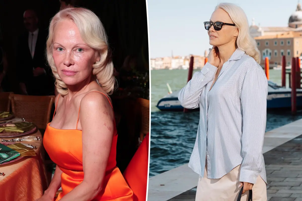 Pamela Anderson was given 10 years to live after hepatitis C diagnosis