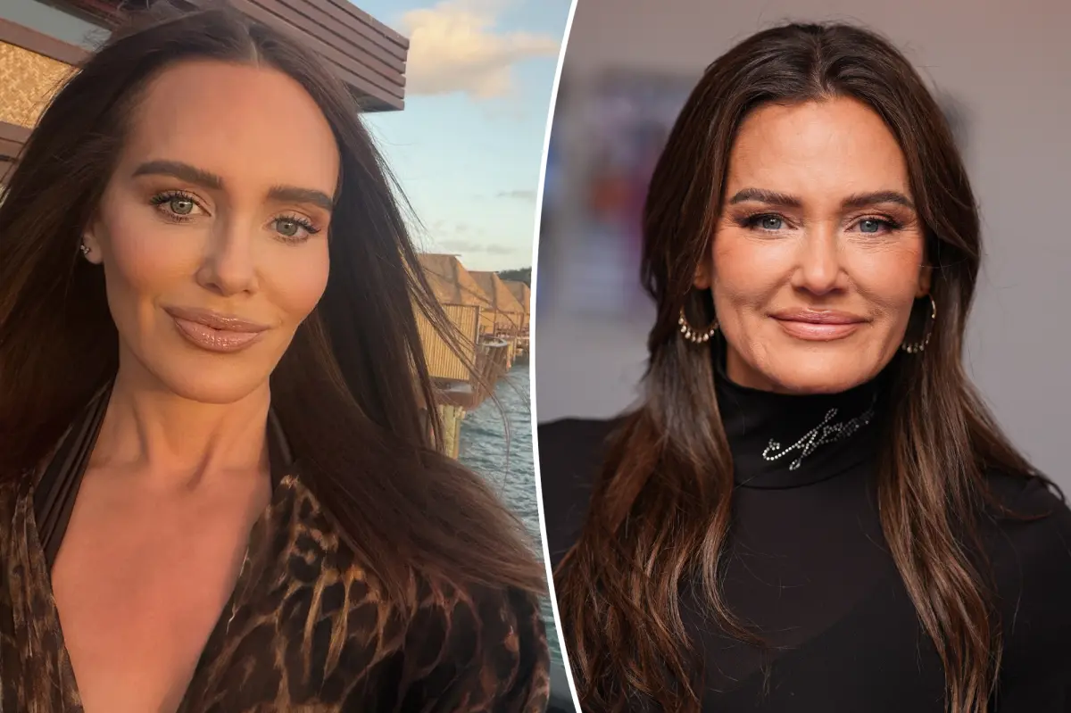 Meredith Marks shares details on her facelift