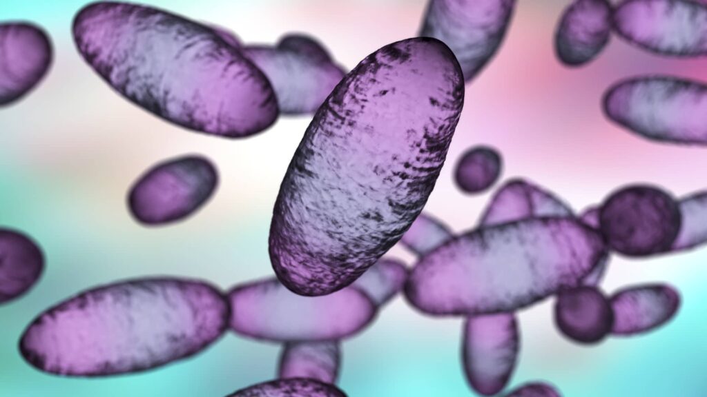 Russian lab worker dies amid plague reports — here’s what we know