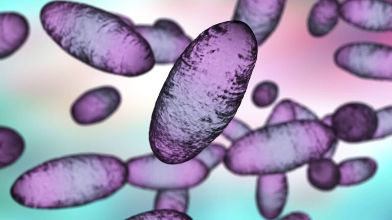 Russian lab worker dies amid plague reports — here’s what we know