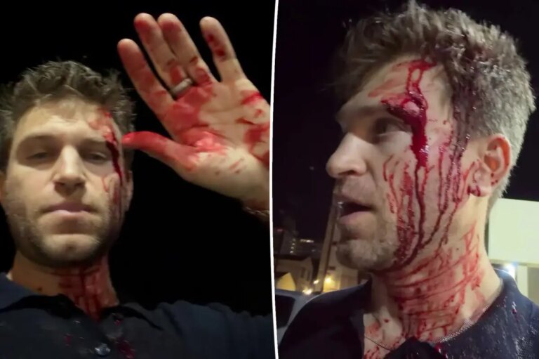 Keegan Allen 911 dispatch audio revealed after actor’s bloody LA grocery store attack